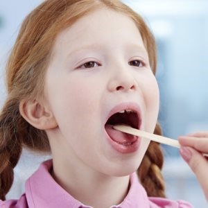 Girl with tonsillitis – Google free image