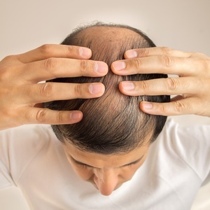5 foods that stop hair loss | Health24