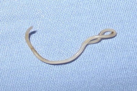 pinworm