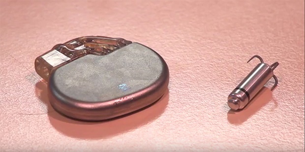 smallest pacemaker