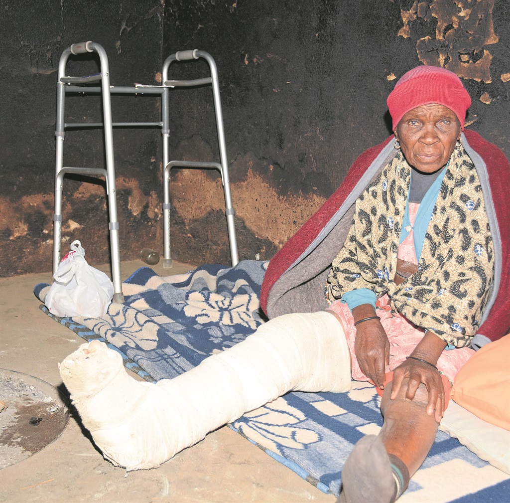 Gogo Mosima Phaho is still nursing her broken leg at home.          Photo by Joshua Sebola 