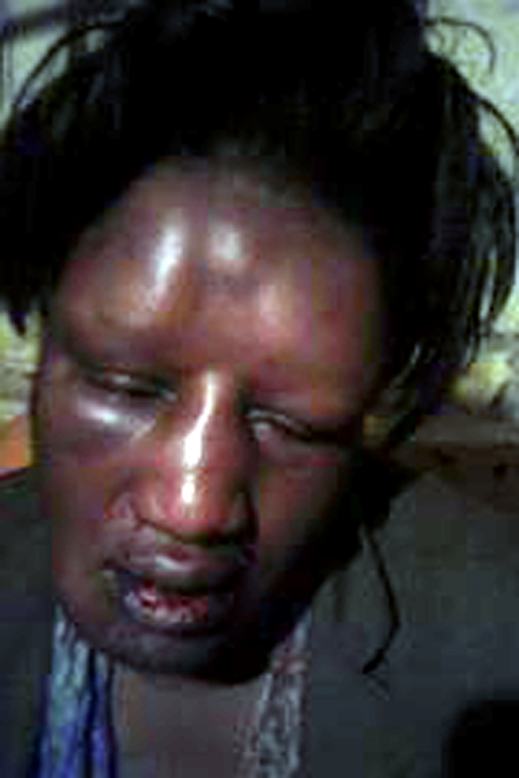 Thandiwe was beaten up by her ex-boyfriend James Thomu. Photo Supplied Photo by   