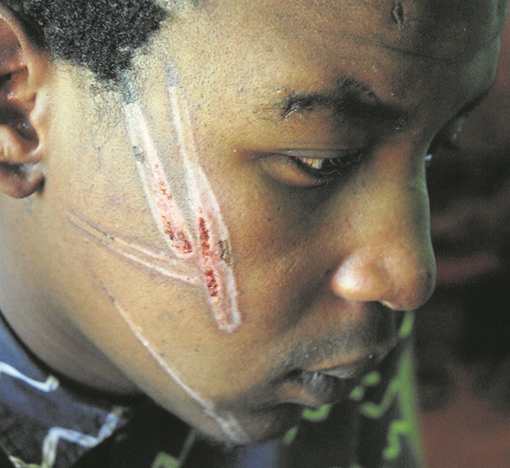 Anenkosi Mapapu was allegedly assaulted by members of the Uncedo Taxi Association in Motherwell, Port Elizabeth.   Photo by                 Chris Qwazi 