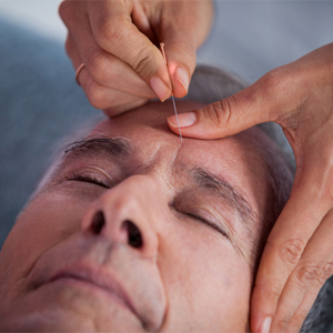 Modern acupuncture is mostly used to stimulate your nerves, muscles and blood flow.