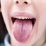 SEE: What does a black, hairy tongue look like?