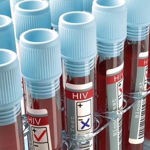 HIV test tubes – iStock