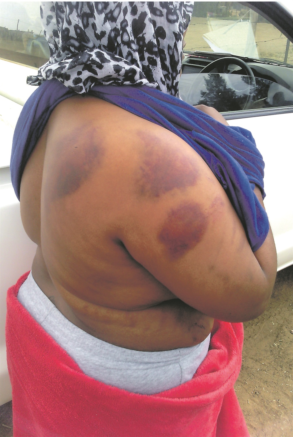 Beauty Maisela was allegedly attacked by an ANC councillor at the weekend.                 Photo by Godfrey Pandeka   
