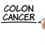 Healthy living reduces everyone's risk of colon cancer