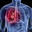Immunotherapy drug shows promise against lung cancer