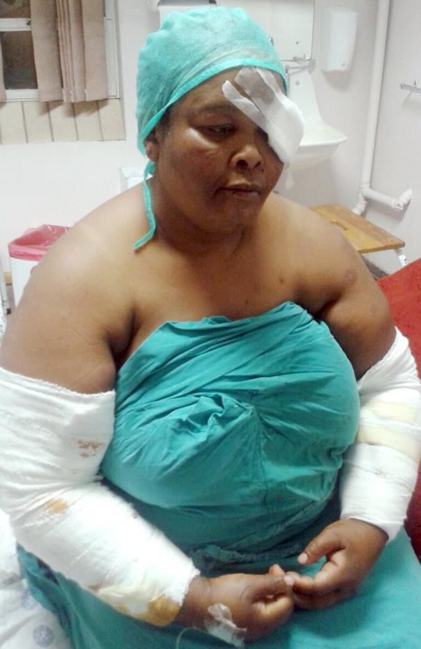 Makhala is 
in hospital after being attacked by her pitbulls.Photo by Kabelo Tlhabanelo