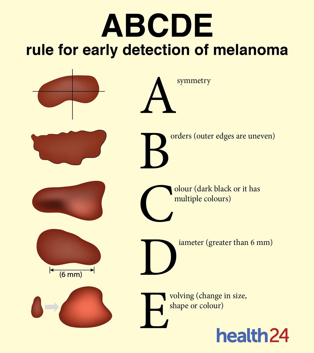 skin cancer, melanoma, sun, skincare