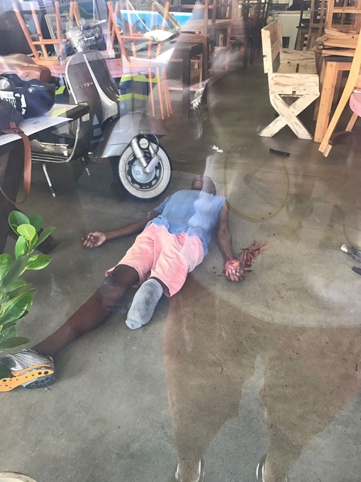 A homeless teen who was beaten up, allegedly by the owner of Baked Bistro in Bakoven on Thursday. Photo: Supplied
