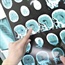 MRI scans before surgery help to protect brain