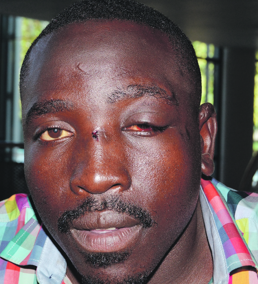 Thulani Moyo claims he was assaulted by Metro cops.Photo by Everson Luhanga