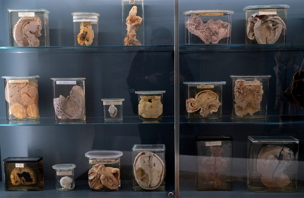 Exhibits of the anatomical pathology collection ar