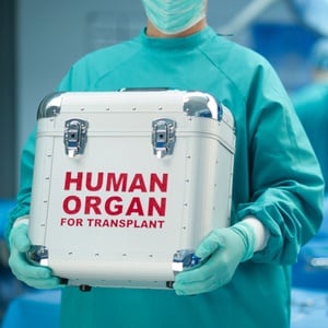 The lifespan of a donated organ depends on several factors. 