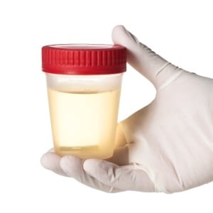 Your urine needs to be the right colour. 