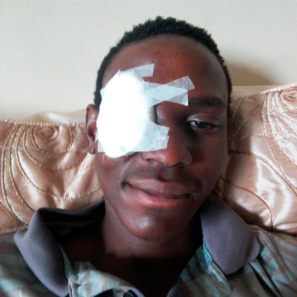Jabulani Mabilane after he was assaulted at the Nelspruit Golf Club in October last year. 