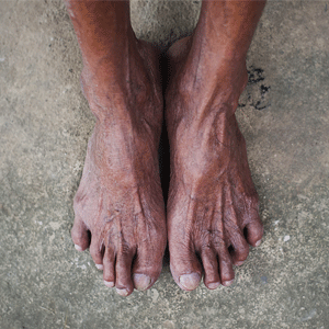 Feet of an old man