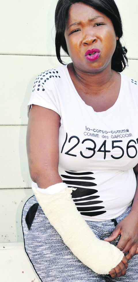 Tebogo Shabalala says the cops robbed her of her dignity and broke her hand.Photo by  Everson Luhanga