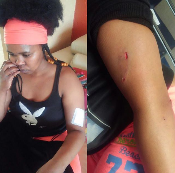 Zahara is recovering after getting stabbed on Tuesday night.
Photo: Instagram