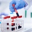 Blood test may gauge death risk after surgery