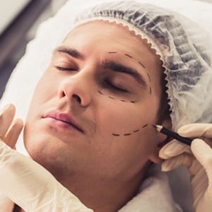 The number of men undergoing plastic surgery is on the rise. 