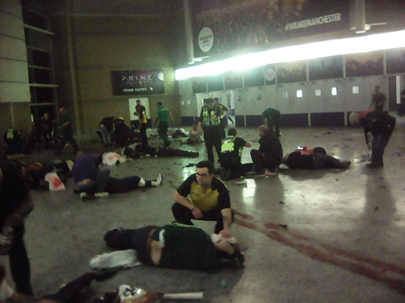 <p><strong>WARNING GRAPHIC IMAGE:</strong></p><p><em>Helpers attend to injured people inside the Manchester Arena. (PA via AP)</em></p>