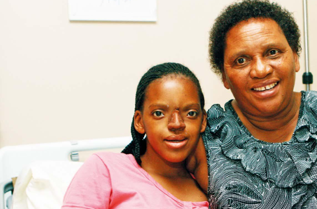 Amukelani Bekwa and her mom, Kokoti, are both happy about the new prosthetic nose. (Photo: Fani Mahuntsi) 