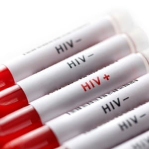 Information about individuals' HIV status should be kept confidential. 