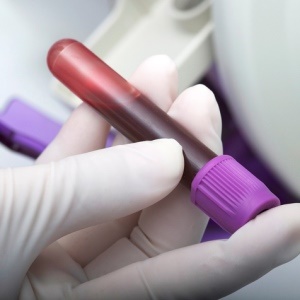 Testing for bone marrow compatibility (iStock)