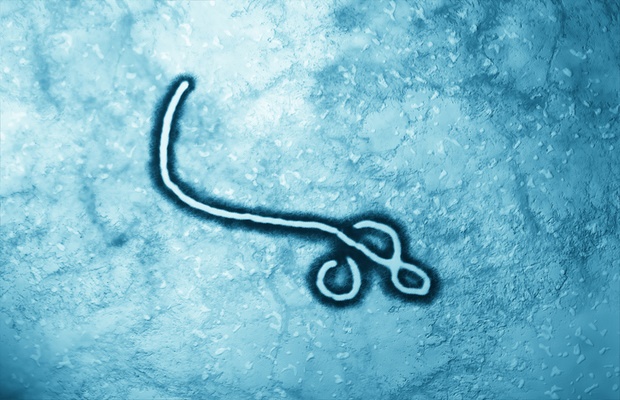 ebola virus under microscope 