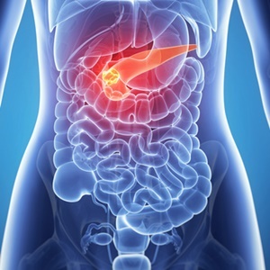 Survival rate for pancreatic cancer is only at 14%.