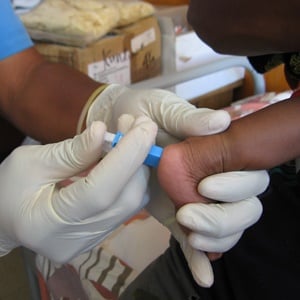 Dry blood spot test (for HIV) on an infant. Wikimedia Commons