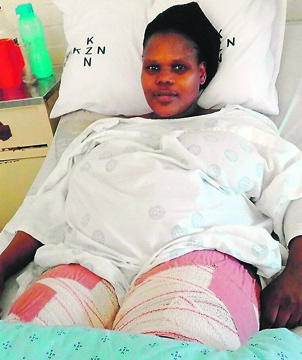 Thandeka Mkhungo believes her legs were injured during an operation in hospital. 