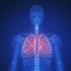 Doctors often don't tell patients about risks of lung cancer screening