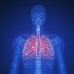 The potential risks of lung cancer screenings need to be discussed with patients. 
