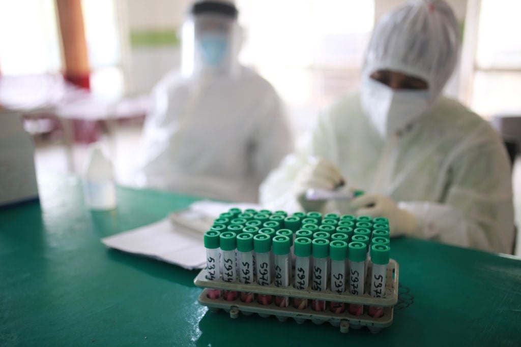 ‘Memalukan bagi kemanusiaan’ – Erdogan menjanjikan 15 juta dosis vaksin Covid-19 untuk Afrika