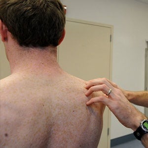 A doctor examines a patient's skin for signs of melanoma. Source: Wikimedia Commons