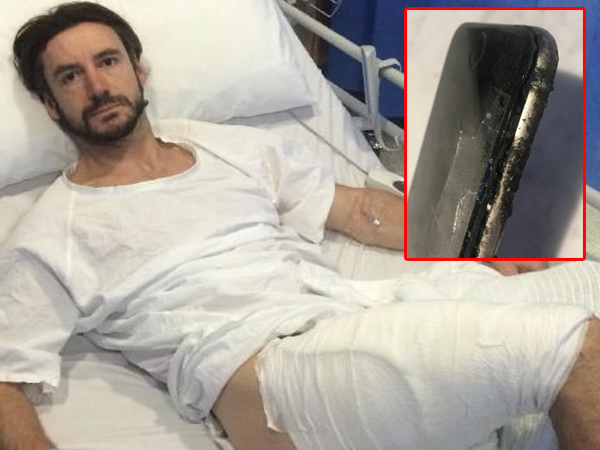 Cyclist Suffers Horrific Burns After His Smartphone Explodes In His Pocket You