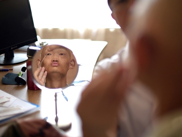 Alien Boy In Plastic Surgery Face Change