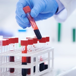Blood tests could soon be used to detect various cancers in their earliest stages. 