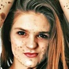 ‘My birthmarks are beautiful’ - woman with rare skin condition