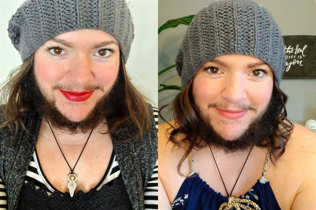 Bearded Woman Who Started Growing Facial Hair At 12 Feels More Confident With Full Beard