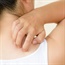 Eczema dramatically impacts quality of life