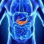 Diabetics show higher risk of acute pancreatitis