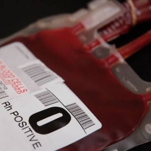 Using your own blood during surgery may simplify matters.