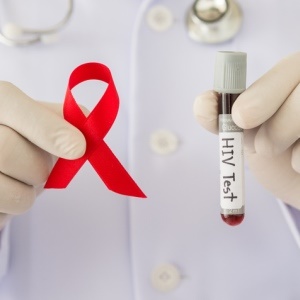 A reported shortage of HIV test kits in Limpopo is cause for concern. 