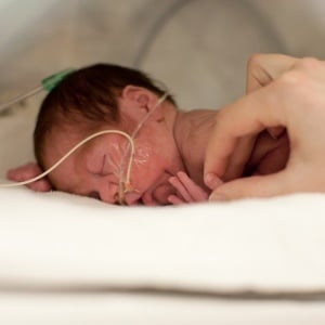 Preterm babies are babies that are born alive before 37 weeks of pregnancy. 