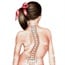 Scoliosis: The test parents can do at home